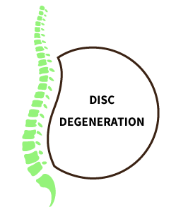 Disc degeneration